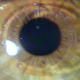 http://www.medicalvision.cz/media/MV_41.jpg